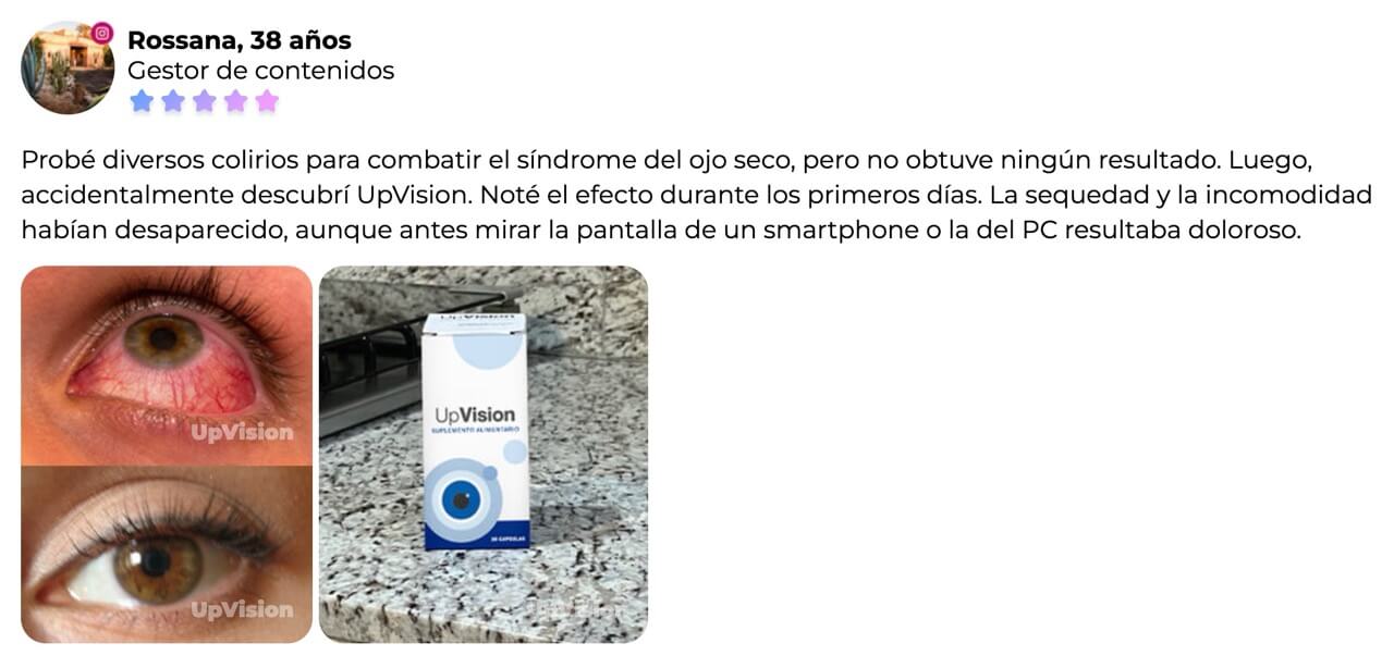 UpVision en Chile: Precio farmacia Cruz Verde, Doctor Simi, Similares ¿Para qué sirve?